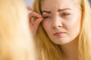 Refresh Your Look with In-Office Upper Eyelid Surgery