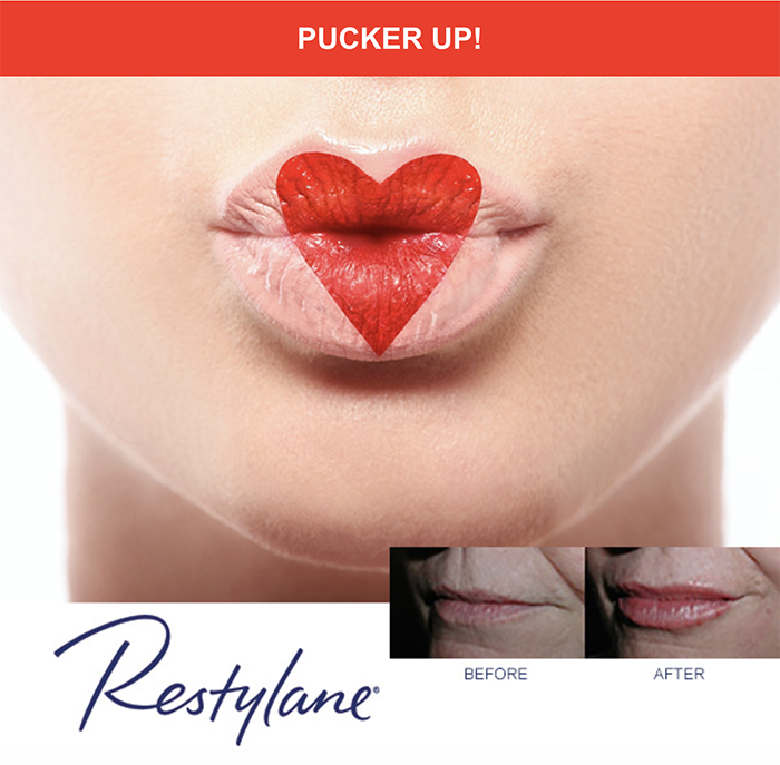 Kissable Lips For Valentine's Day From Dr. Chatham